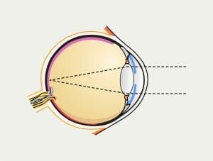  Diagram över det mänskliga ögats uppbyggnad.